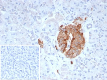 IHC staining of FFPE human pancreas tissue with Collagen IV antibody (clone COL4/9395R). Inset: PBS 