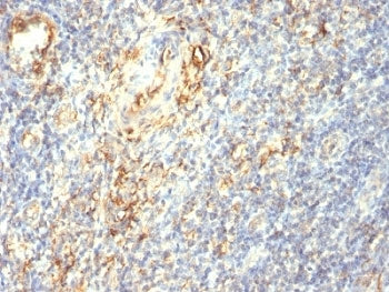 IHC: Formalin-fixed, paraffin-embedded human tonsil stained with Transglutaminase 2 antibody (TGM2/4