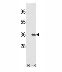 Western blot analysis of IL-1 alpha antibody and 293 cell lysate (2 ug/lane) either nontransfected (