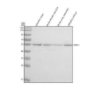 Western blot analysis of Srp54 protein using Zebrafish Srp54 antibody and 1) zebrafish head, 2) whol
