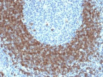 IHC testing of FFPE human tonsil tissue with CD79b antibody (clone IGB/1842). HIER: boil tissue sect