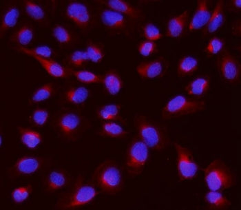 NME2 Antibody