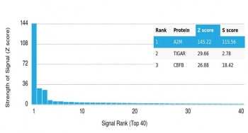 A2M Antibody / Alpha-2-Macroglobulin