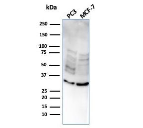 Western blot testing of human PC-3 and MCF-7 cell lysate with NKX2.8 antibody. Predicted molecular w