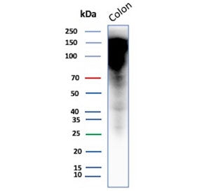 Western blot testing of human colon tissue with CEA antibody (clone CEACAM5/12673). Predicted molecu