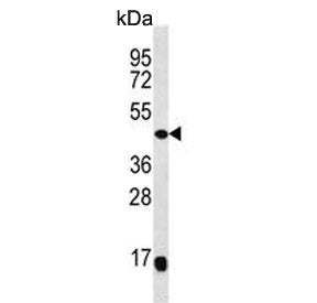 Western blot testing of human Y79 cell lysate with MEK4 antibody. Predicted molecular weight ~44 kDa