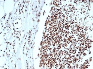 IHC staining of FFPE human lymph node with XRCC5 antibody (clone XRCC5/7318). HIER: boil tissue sections in pH 9 10mM Tris with 1mM EDTA for 20 min and allow to cool before testing.
