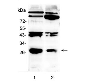 PDGF beta Antibody