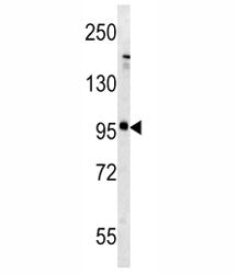 Glutamate Receptor 5 Antibody (metabotropic)