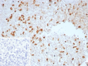 TGFB Antibody / TGF beta