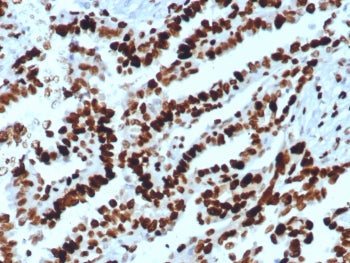 Western blot testing of human A431 cell lysate with MCM2 antibody. Commonly observed at 100-130 kDa.
