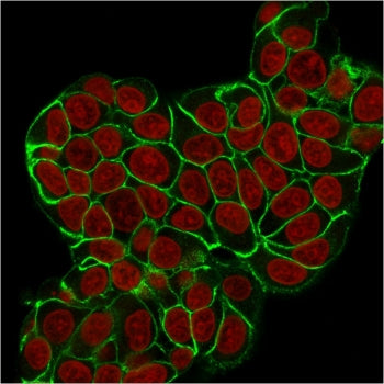 Immunofluorescent staining of human MCF7 cells with recombinant E-Cadherin antibody (clone CDH1/2208