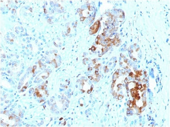 FTL Antibody / Ferritin light chain