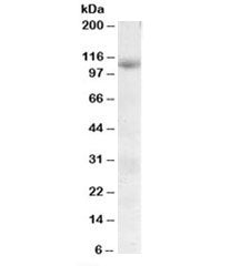 Western blot testing of human skeletal muscle lysate with SNX19 antibody at 0.3ug/ml. Predicted/obse
