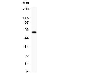 Western blot testing of DR3 antbody and COLO320 lysate. Predicted molecular weight: 45 kDa, observed