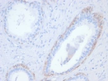 Cytokeratin 14 Antibody / CK14 / KRT14