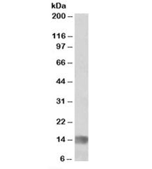 Western blot testing of human glioma lysate with MIA antibody at 1ug/ml. Predicted molecular weight: