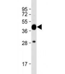 Western blot testing of E. coli lysate with MBP tag antibody at 1:16000. Predicted molecular weight: