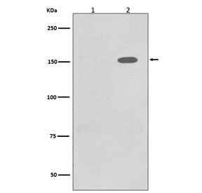 Western blot testing of lysate from human A431 cells 1) untreated and 2) treated with EGF, with phos