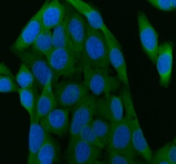 SIP Antibody / SIAH Interacting Protein