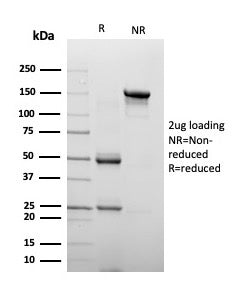 Chromogranin A Antibody