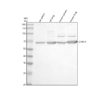 Western blot analysis of SLFN12 using anti-SLFN12 antibody. Electrophoresis was performed on a 10% S