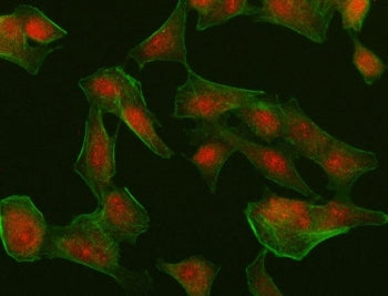 Immunofluorescent staining of FFPE human A549 cells with Interferon regulatory factor 4 antibody (re