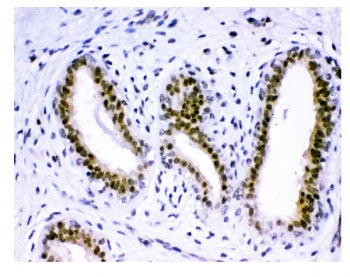 KDM5B Antibody / Jarid1B
