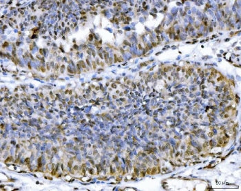 ACL Antibody / ATP Citrate Lyase