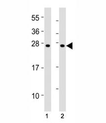 SOCS1 Antibody