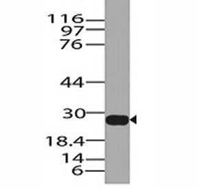 Western blot analysis of human stomach lysate using Granzyme B antibody. Predicted molecular weight: