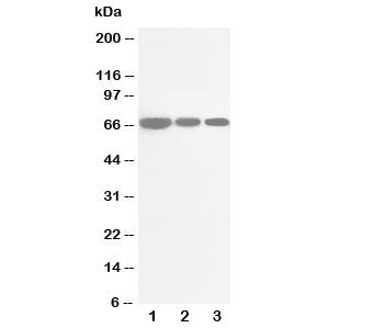 Western blot testing of CDC25B antibody and Lane 1: rat brain; 2: rat kidney; 3: rat lung tissue lys