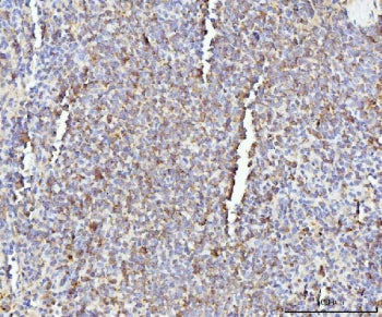 Il-17a Antibody