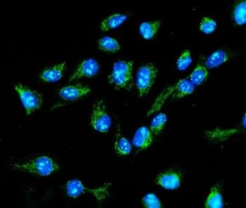 Immunofluorescent staining of FFPE human U-2 OS cells with Monofunctional C1-tetrahydrofolate syntha