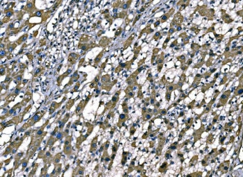 Superoxide Dismutase 2 Antibody / SOD2
