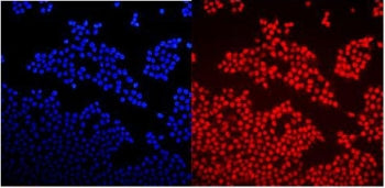 Immunofluorescent staining of FFPE human A431 cells with GNAQ antibody (red) and DAPI nuclear stain 