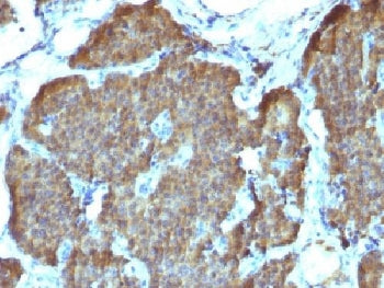 NSE Antibody / Neuron Specific Enolase