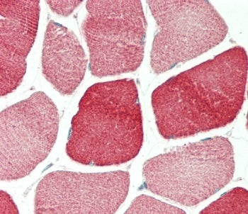 IHC testing of FFPE human skeletal muscle tissue with Tropomyosin 4 antibody. HIER: steam section in