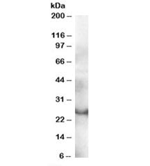 Western blot testing of human thymus lysate with GRAP antibody at 0.3ug/ml. Predicted molecular weig