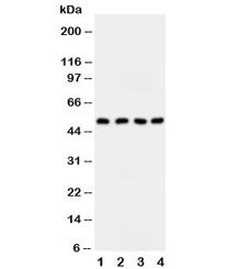 SPTLC1 Antibody