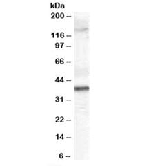 Western blot testing of human skin lysate with GALR3 antibody at 2ug/ml. Predicted molecular weight 
