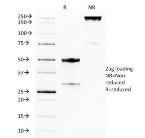 SDS-PAGE Analysis of Purified, BSA-Free GITR Antibody (clone DTA-1). Confirmation of Integrity and P