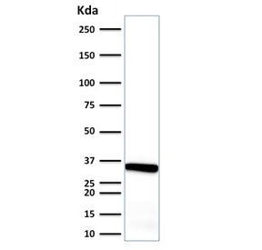 Calponin 1 Antibody