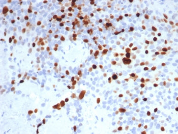 IHC staining of FFPE human lymph node tissue with Topoisomerase II alpha antibody (clone TOP2A/8103R