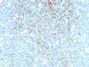 CD23 Antibody