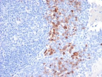 IHC staining of FFPE human tonsil tissue with SCD1 antibody (clone SDC1/7183). HIER: boil tissue sec