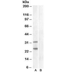 Western blot of HEK293 lysate overexpressing human SOCS1 and tested with SOCS1 antibody at 1ug/ml (m