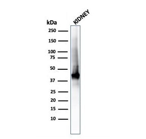 Western blot testing of human kidney lysate with recombinant AMACR/p504S antibody (clone rAMACR/1864
