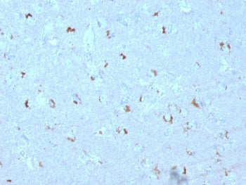 IHC testing of FFPE human brain with GAD67 antibody (clone GAD1/2563). Required HIER: boil tissue se