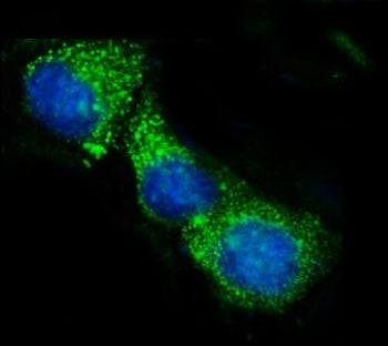 ACADS Antibody / SCAD